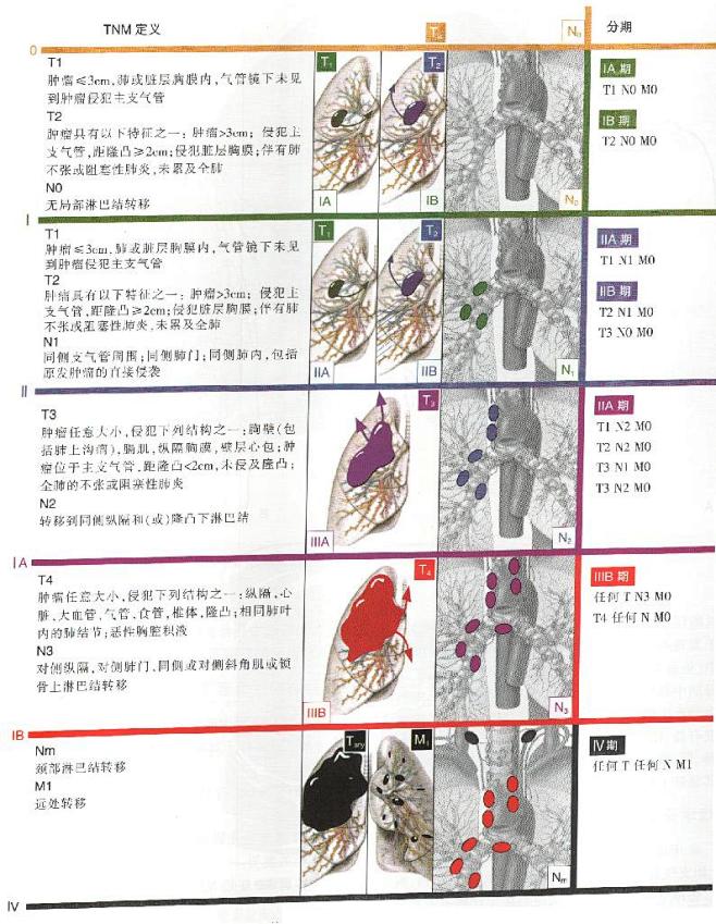 sqf10000采集到肺癌 腺癌tnm分期_飞华健康网