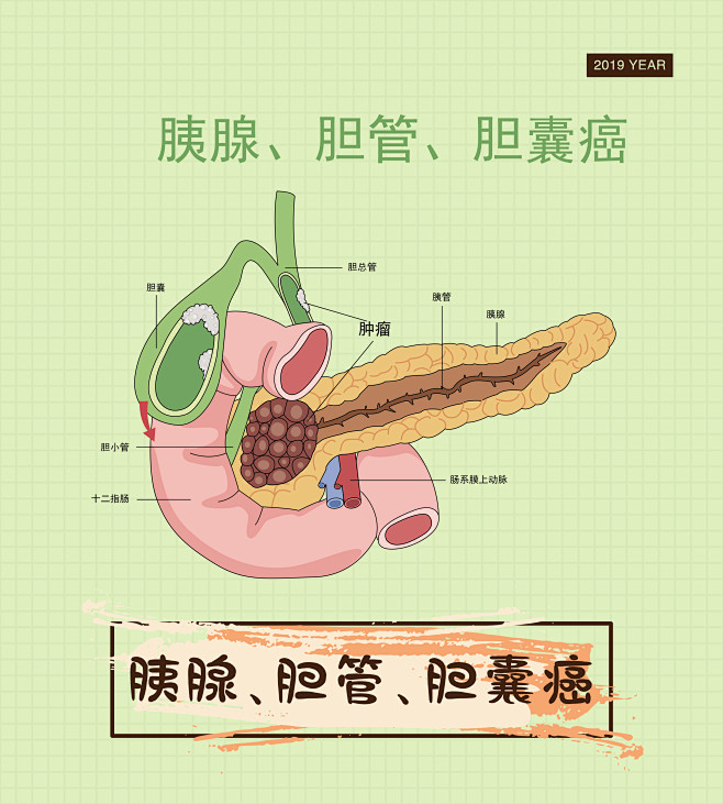 胰腺胆管胆囊癌人体消化系统肿瘤癌症细胞疾病症状医疗人体系统人体