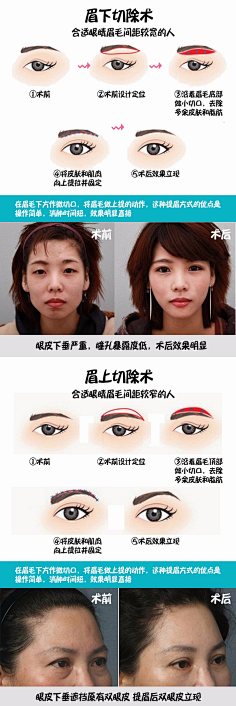 提眉