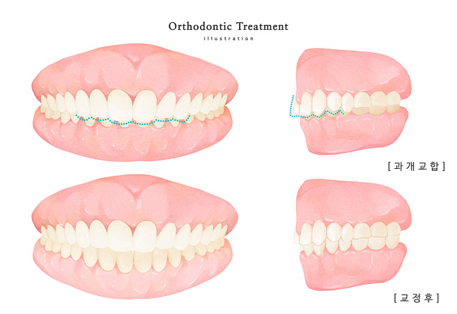 牙齿美容 咬合线 美丽牙齿 健齿插图插画.