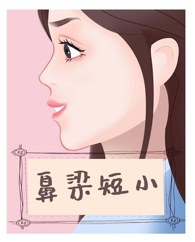 鼻梁短小鼻子鼻头鼻梁医疗美容整形插画卡通手绘漫画可爱女孩美女脸部面部症状系列