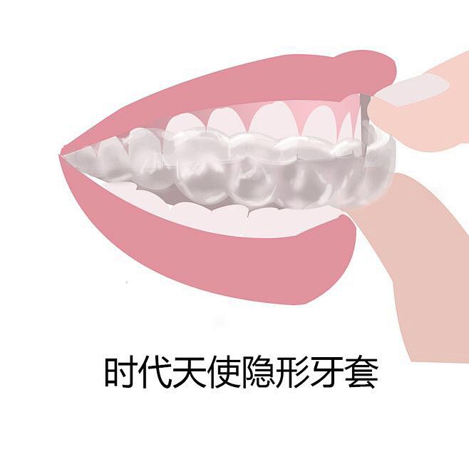 牙齿不同类型 牙齿 牙套 口腔 医疗美容整形插画