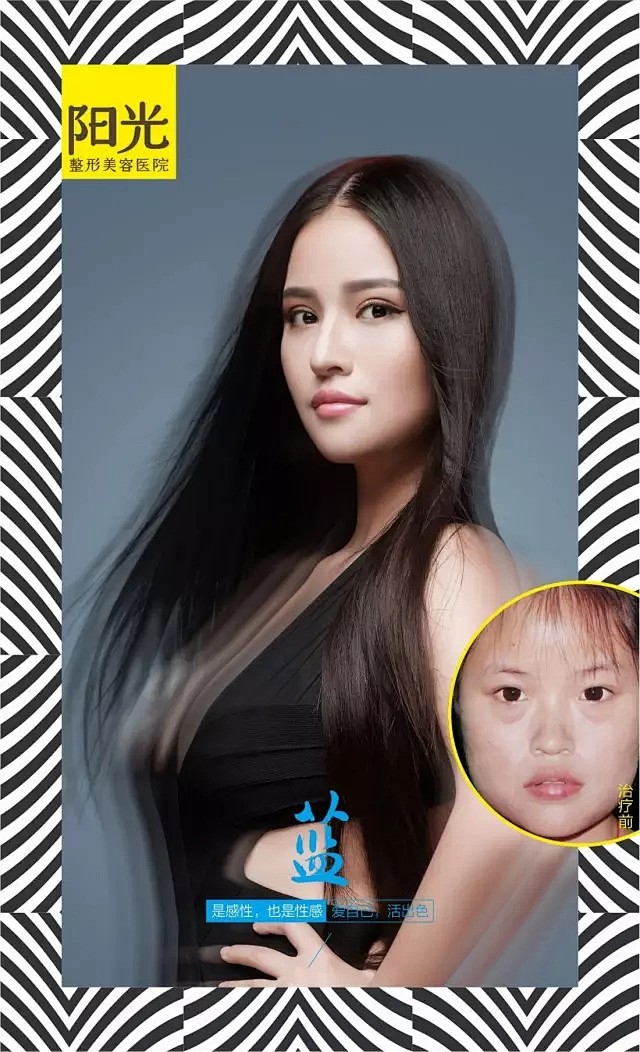 深圳阳光整形美容医院_深圳整形医院_华南整