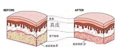 ✎﹏ℳ๓₯㎕梁ω采集到光纤溶脂