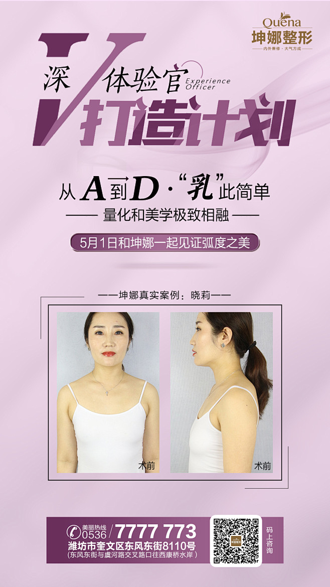 丰胸案例整形丰胸隆胸医美