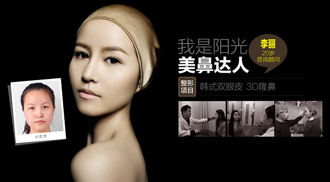 真人案例_整容前后照片_深圳整形案例-深圳阳