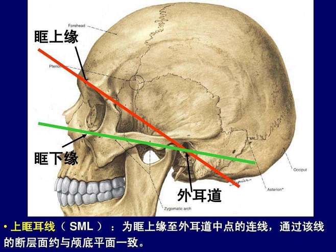 素描头像