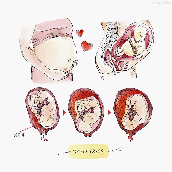 孕妇生产过程 动画图片