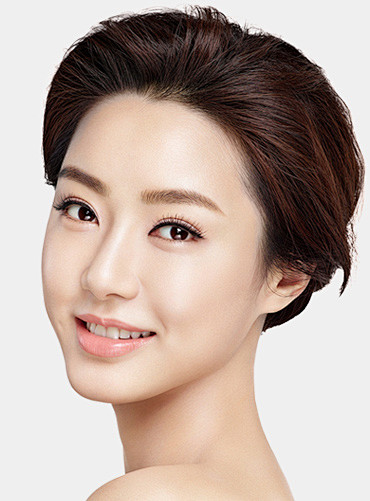 华美韩式综合美眼_韩式双眼皮_贵阳华美整形