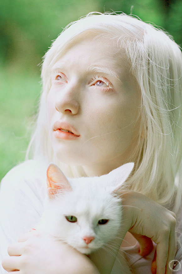 俄罗斯白化病模特nastya