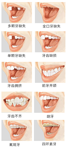 暴走的小小熊采集到人物
